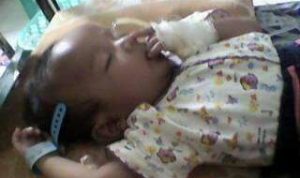 Menderita Gizi Buruk, Seorang Balita Meninggal Dunia Menderita Gizi Buruk, Seorang Balita Meninggal Dunia