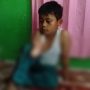 Bocah Korban Sengatan Listrik di Cianjur Butuh Bantuan Dermawan