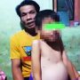 Bocah Asal Mande Cianjur Alami Pembengkakan Perut