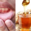 Ini Minuman Herbal yang Bisa Meredakan Sariawan! No 4 Paling Manjur