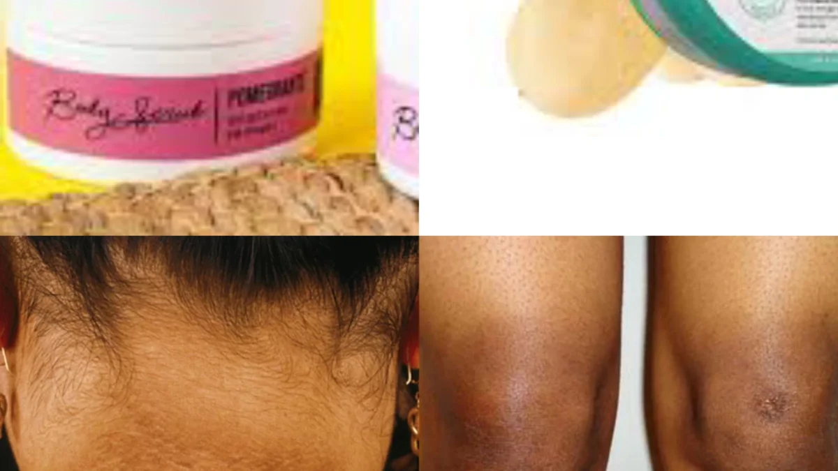Solusi yang Tepat Untuk Hilangkan Lipatan Hitam di Badan