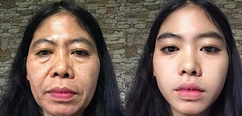 Cara Mengencangkan Kulit di Usia 50 Tahun Secara Alami, No 1 Paling Ampuh(yt@bindiatamayo)