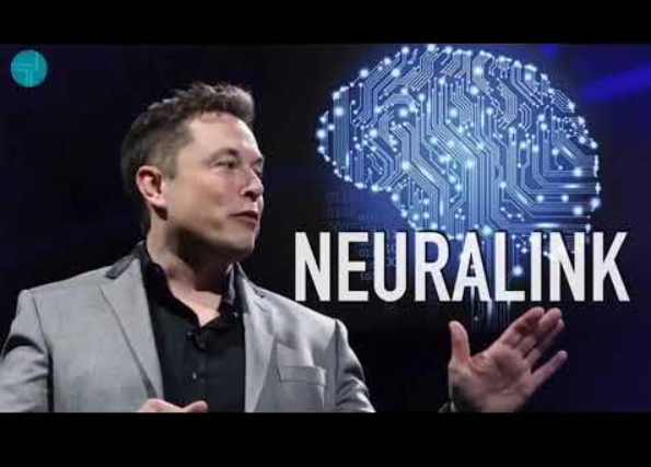Gila! Elon Musk Tanam Chip di Otak Manusia, Gimana Hasilnya? Elon Musk Tanam Chip di Otak Manusia