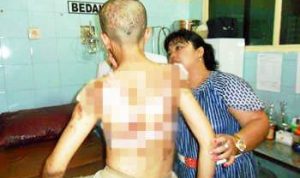 9 Tahun Disiksa Sampai Disetrika