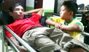 Penyakit ALS Belum Ada Obatnya