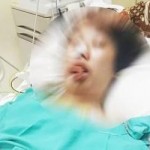 Atlet Catur Kabupaten Bandung Koma