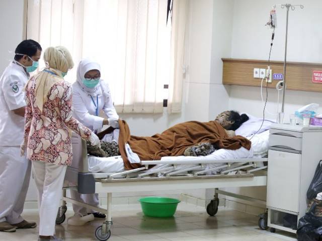 Dede Manusia Akar Bakal Jalani Operasi Dede Manusia Akar