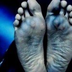 Tiga Korban Tersambar Petir Berangsur Pulih