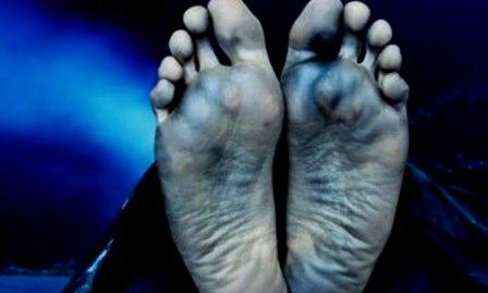 Dua Petani Tewas Tersambar Petir, Tiga Lainnya Luka Serius