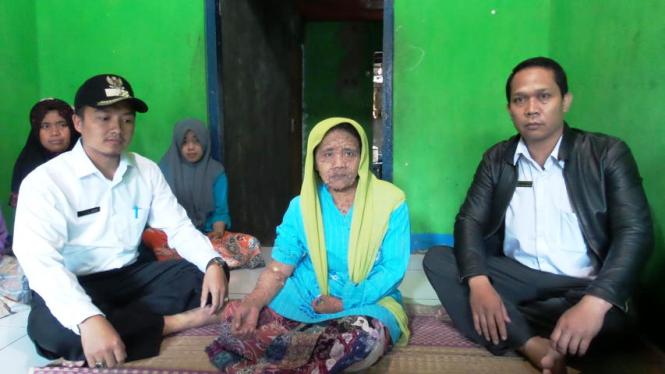 30 Tahun Sekujur Tubuh Penuh Kutil, Belum Punya Jaminan Kesehatan tubuh penuh kutil