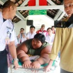 Obesitas Arya Permana