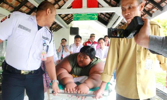 Lambung Arya Dikecilkan Obesitas Arya Permana