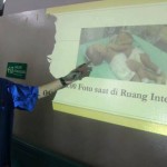 prescon-bayi-kembar-siam