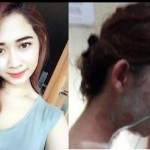 Wajah Intan Hancur Seketika