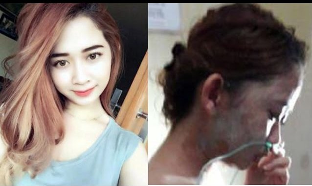 Wajah Intan Hancur Seketika