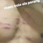 febri