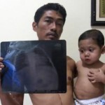 Mata dan Tubuh Menguning Dikira Kurang Dijemur