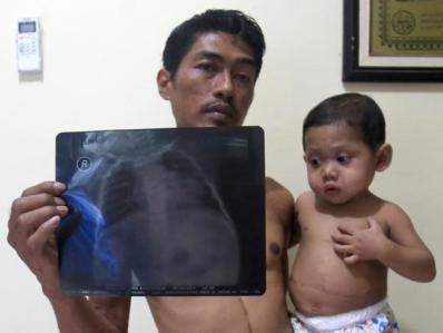 Mata dan Tubuh Menguning Dikira Kurang Dijemur