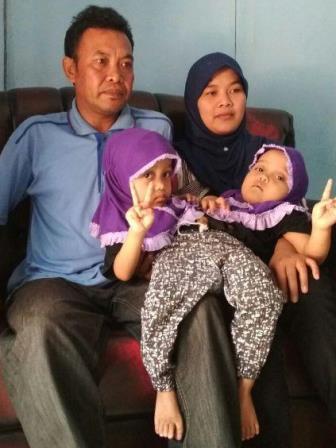 kembar siam garut