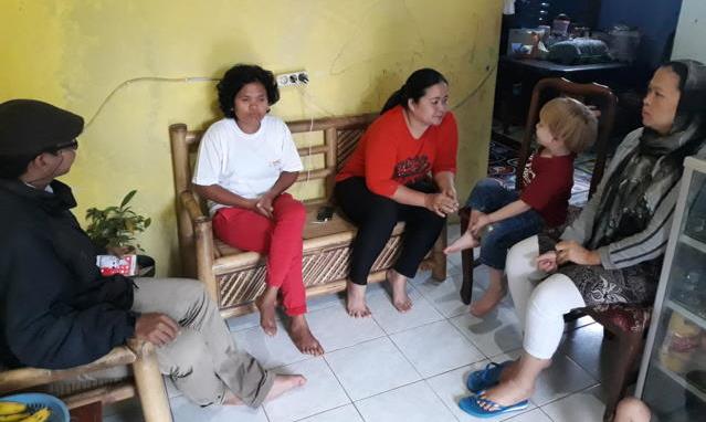 Kembar Siam dari Padalarang di Tangani RSHS