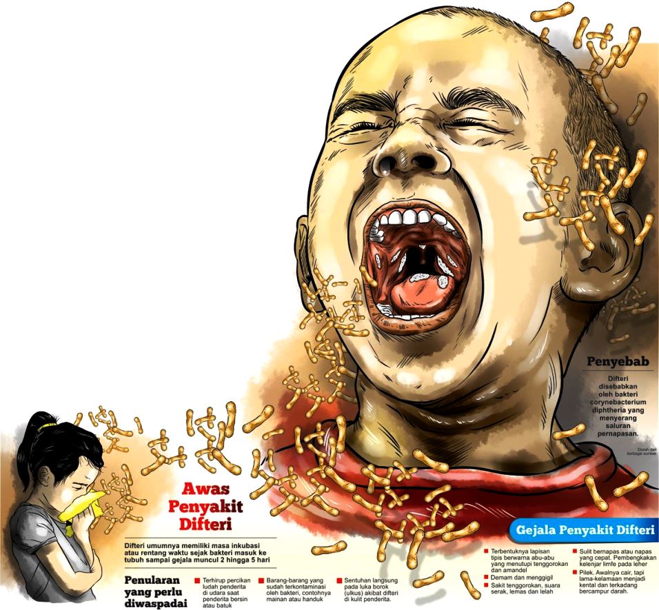 18 Daerah KLB Difteri