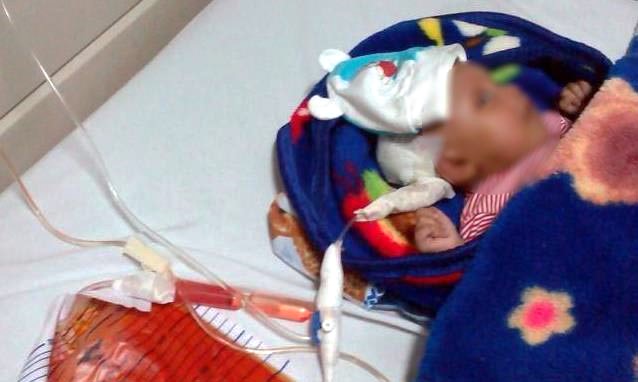 Hana Idap Kelainan Tulang Belakang Hana Idap Kelainan Tulang Belakang