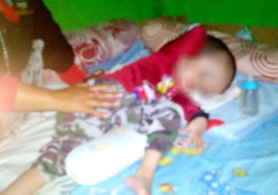 Penderita Hidrocepalus Segera Dibantu Pemdes