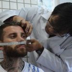 Berharap Cedera Hidungnya Segera Pulih