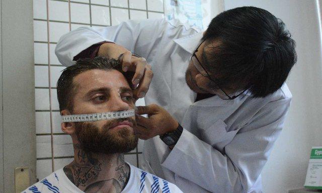 Berharap Cedera Hidungnya Segera Pulih