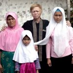 Melihat Kehidupan Kampung Albino atau Sunda Walanda di Garut