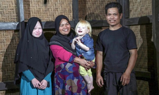 Bapak-Ibu Normal, Dua Anaknya seperti Bule