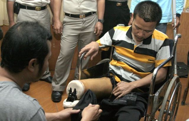 60 Disabilitas dapat Bantuan Kaki Palsu