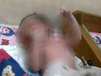 Tutupi Keguguran, LM Curi Bayi