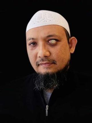 Polri Tantang Novel Ungkap Dalang Penyiraman Air Keras Polri Tantang Novel Ungkap Dalang Penyiraman Air Keras