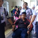 Arya Permana Jalani Operasi Bedah Plastik