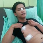 Sekelompok Orang Tusuk Dua Mahasiswa Unjani