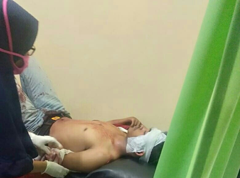 Gara-gara Saling Ejek, Siswa SMP ini Dikeroyok Kemudian Ditusuk Temannya Sendiri