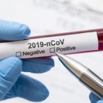 8 Warga Sekitar Secapa Reaktif Covid-19