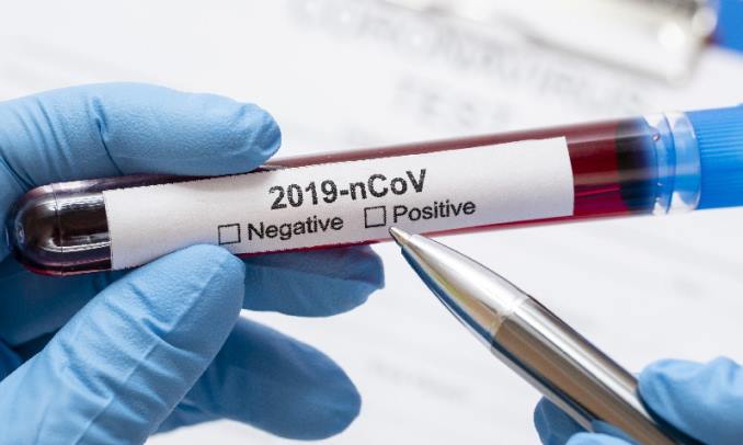 8 Warga Sekitar Secapa Reaktif Covid-19