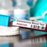 Tak Hanya Sinovac, Vaksin Korsel dan Inggris Segera Diuji Klinis