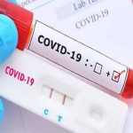 8 Orang Warga Sumedang Kembali Terpapar COVID-19