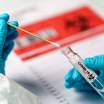 Cegah Penularan, Dinkes Kabupaten Bandung Terus Lakukan PCR Swab Test