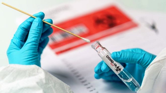 Cegah Penularan, Dinkes Kabupaten Bandung Terus Lakukan PCR Swab Test