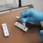 Antisipasi Penyebaran Covid-19, Dinkes Gelar Rapid Test di Terminal
