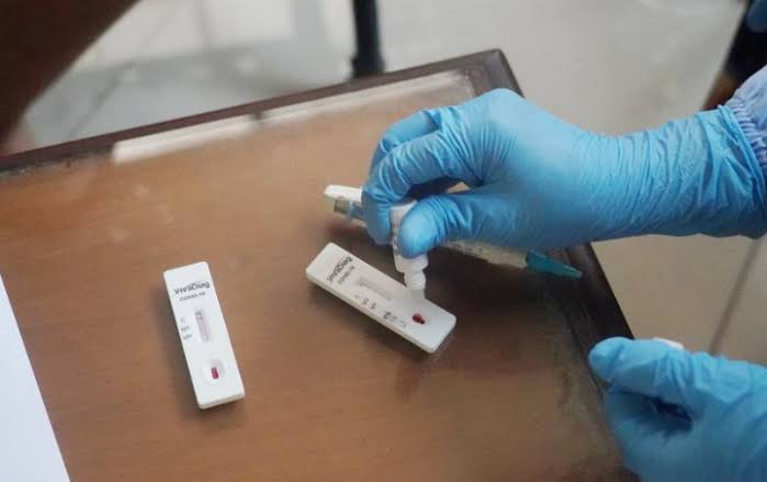 Antisipasi Penyebaran Covid-19, Dinkes Gelar Rapid Test di Terminal