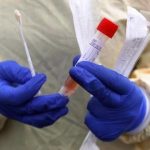 Pemkot Bakal Sanksi Faskes Pelanggar Batas Tarif Swab Test