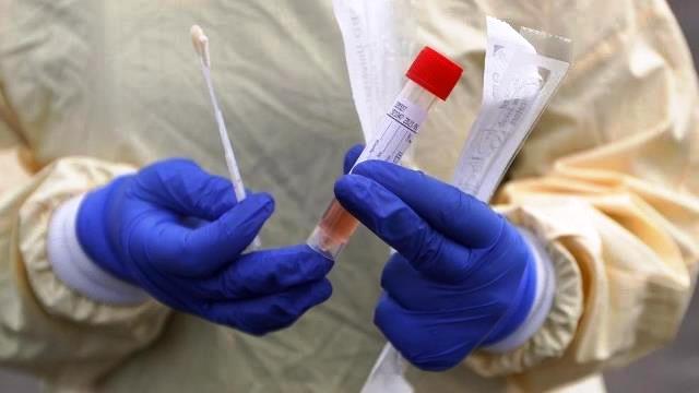 Pemkot Bakal Sanksi Faskes Pelanggar Batas Tarif Swab Test Pemkot Bakal Sanksi Faskes Pelanggar Batas Tarif Swab Test