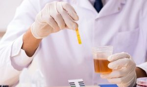 Air Kencing Anda Berwarna Gelap? Waspada Penyakit Ini! Air Kencing Anda Berwarna Gelap? Waspada Penyakit Ini!