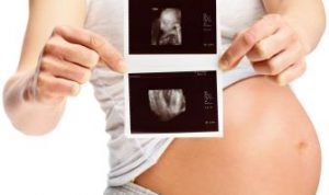Walau Sedang Mengandung, Wanita Ini Ternyata Hamil Lagi