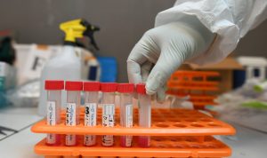 vaksin astrazeneca covid-19 pfizer moderna sinovac